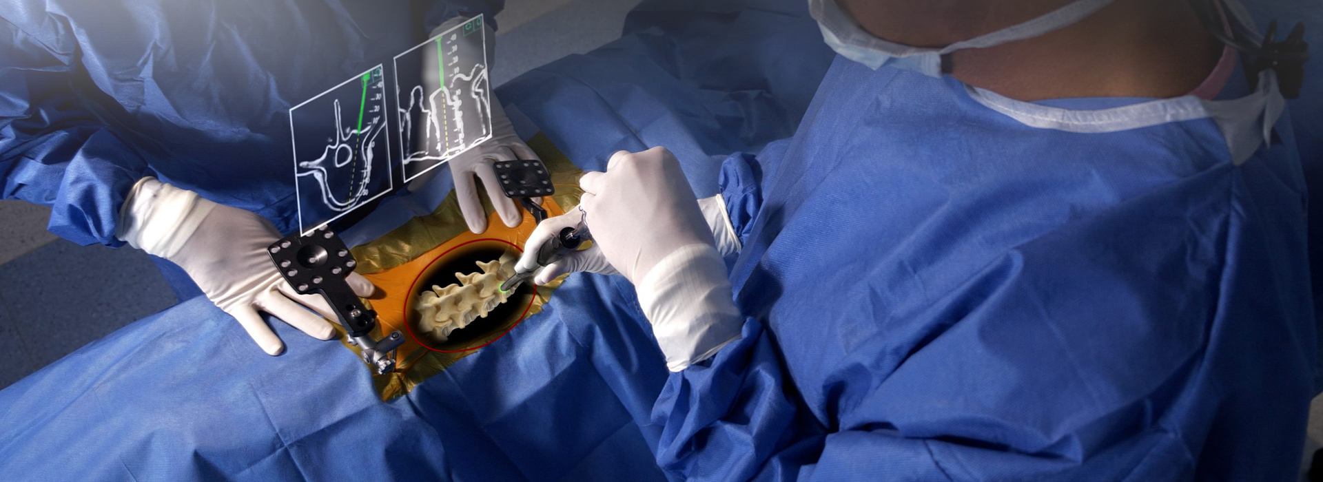 Endoscopic Spine Surgery in Ahmedabad