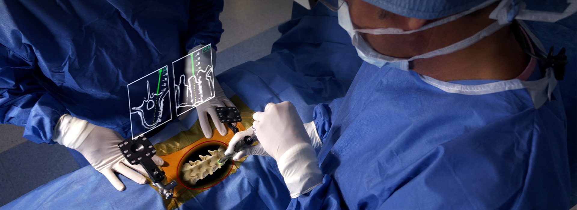 Minimally Invasive Spine Surgery in Ahmedabad:Why Patients Prefer It?