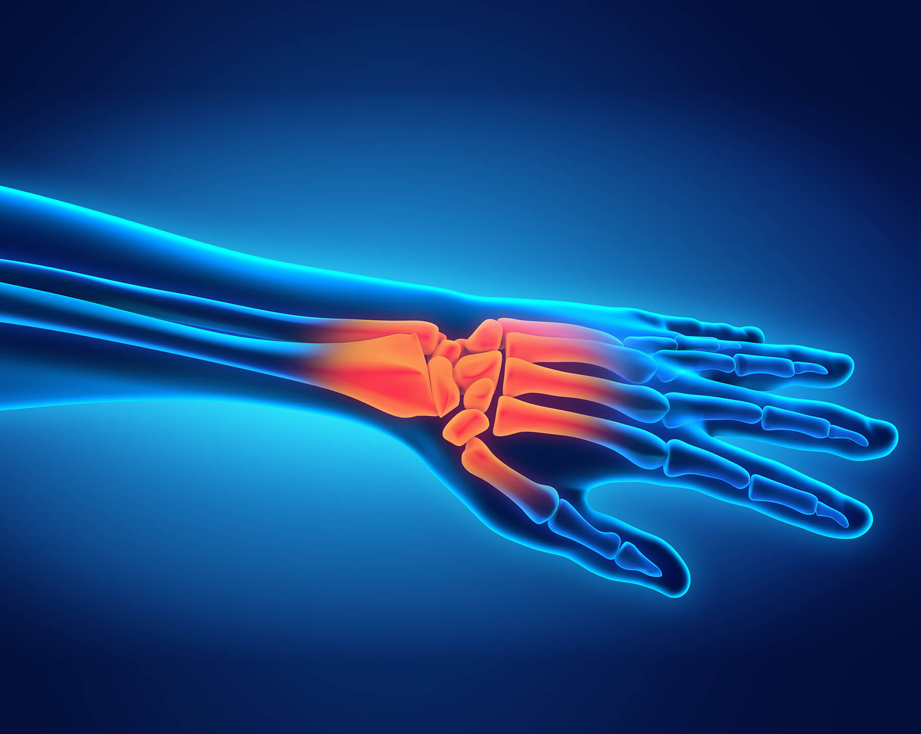 Arm Pain Treatment Arm Pain Treatment in Vastrapur, Ahmedabad