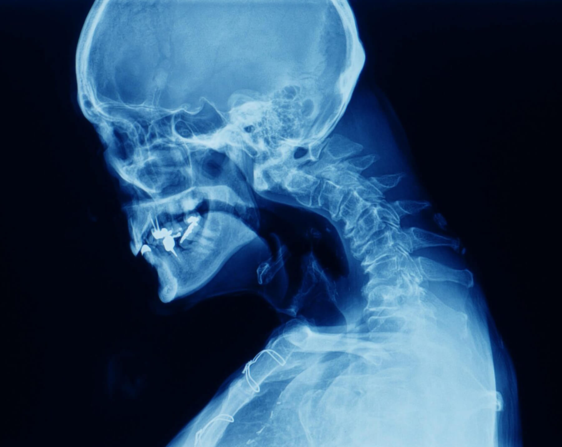 Orthopedic Doctor in Ahmedabad Orthopedic Doctor in Ahmedabad