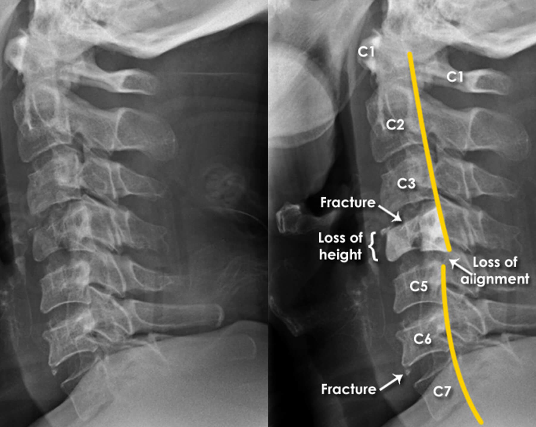 Orthopedic Doctor in Ahmedabad Orthopedic Doctor in Ahmedabad