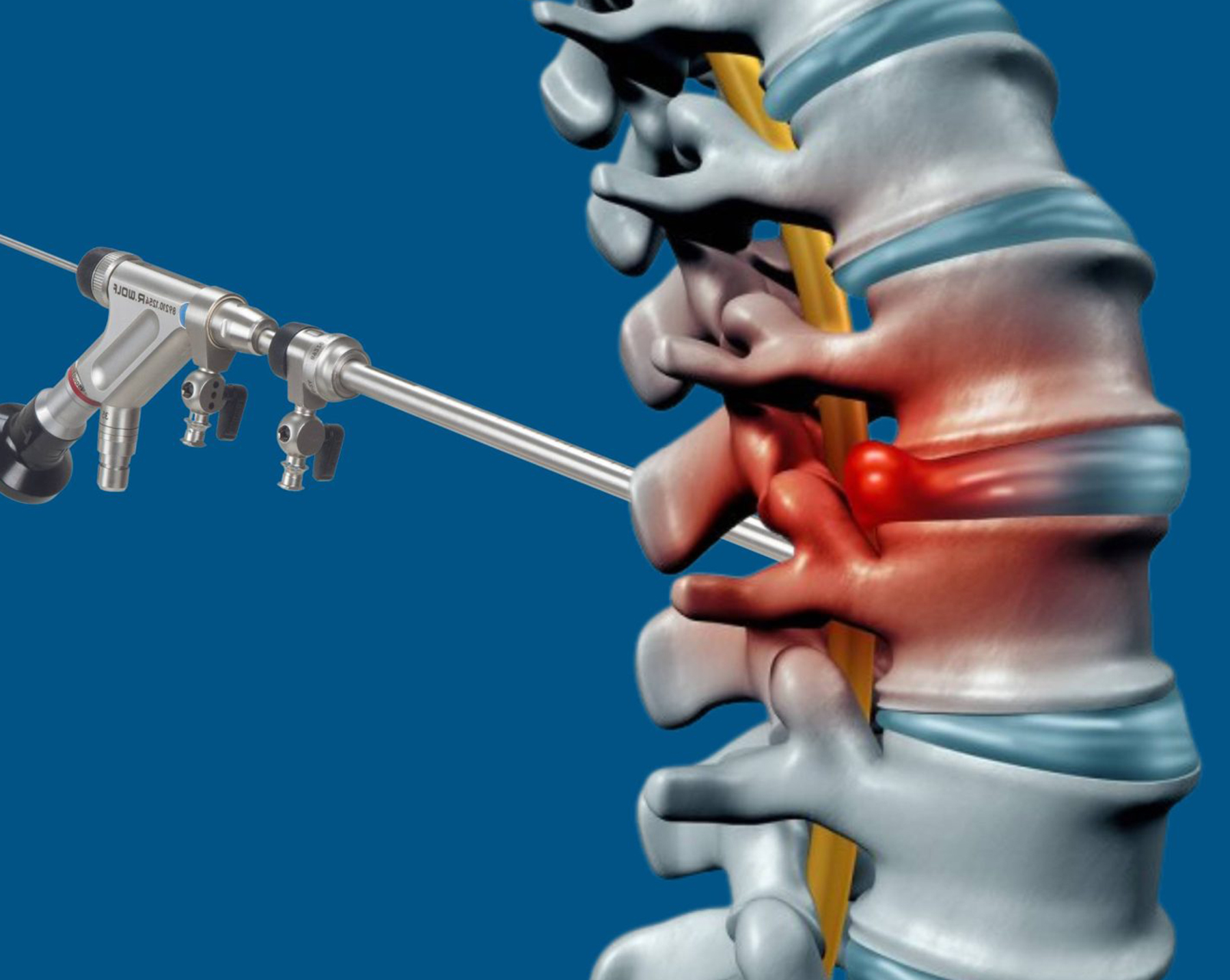 Orthopedic Doctor in Ahmedabad