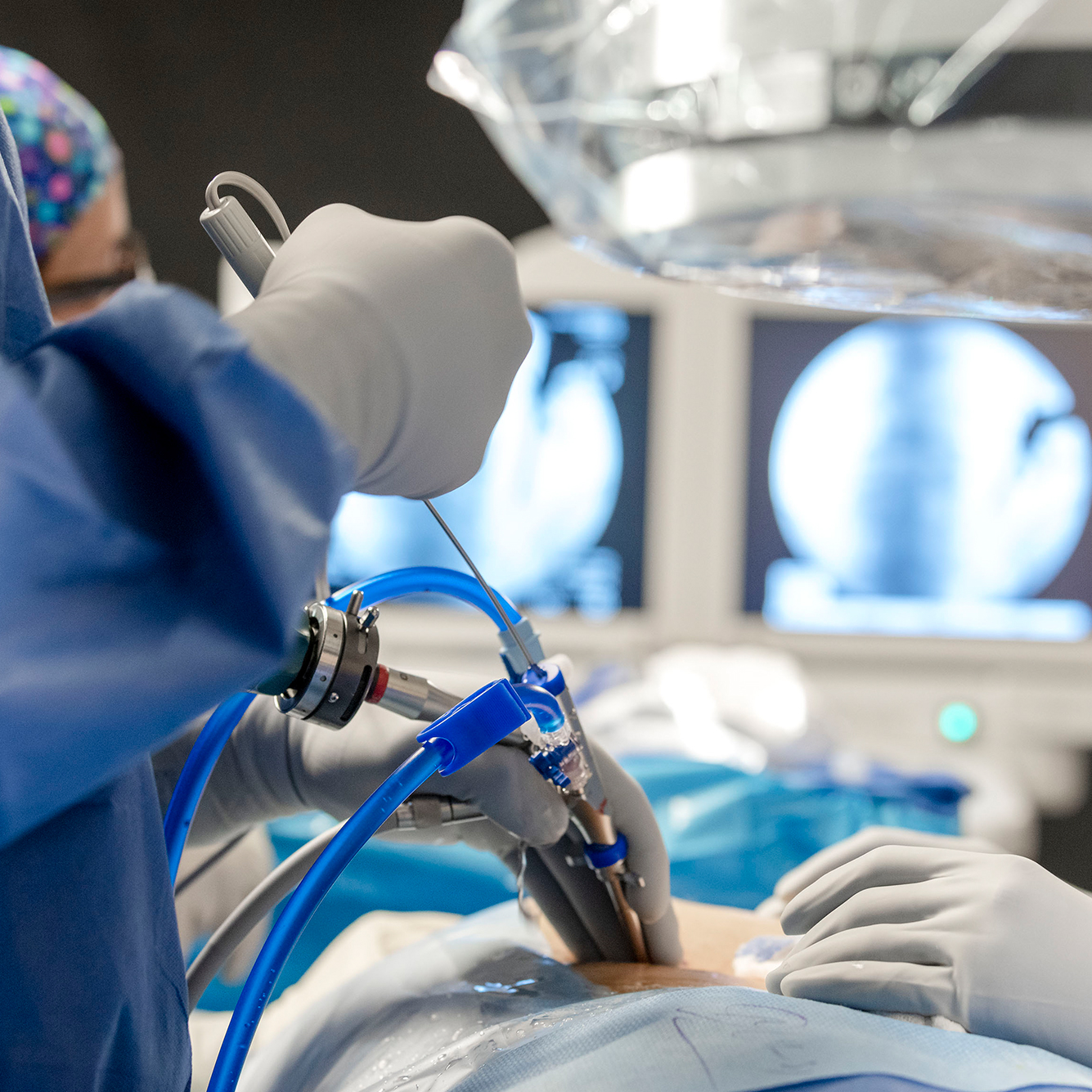 Endoscopic Spine Surgeon in Ahmedabad