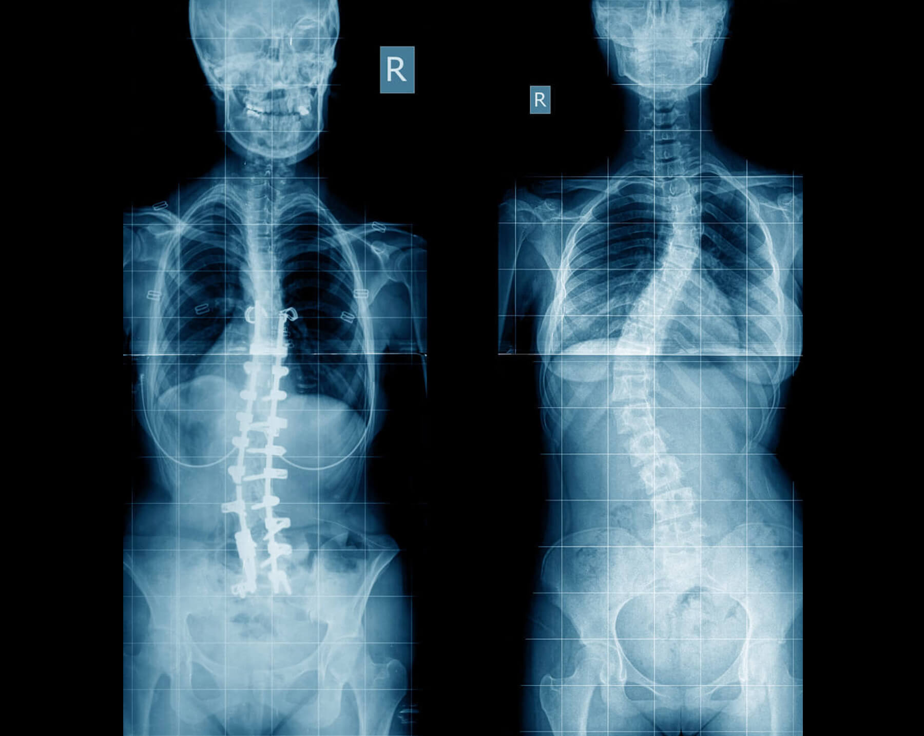 Orthopedic Doctor in Ahmedabad Orthopedic Doctor in Ahmedabad