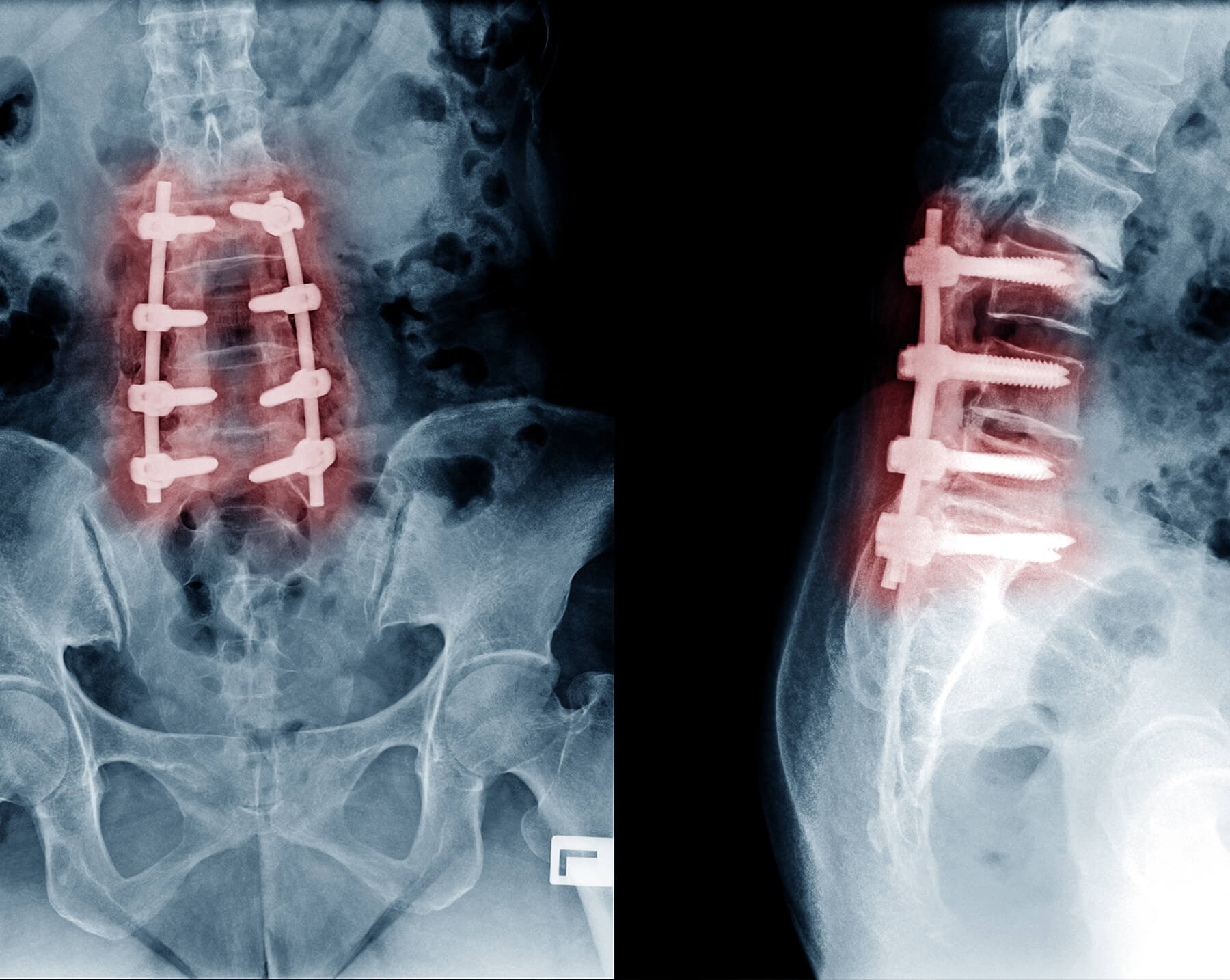 Orthopedic Doctor in Ahmedabad Orthopedic Doctor in Ahmedabad
