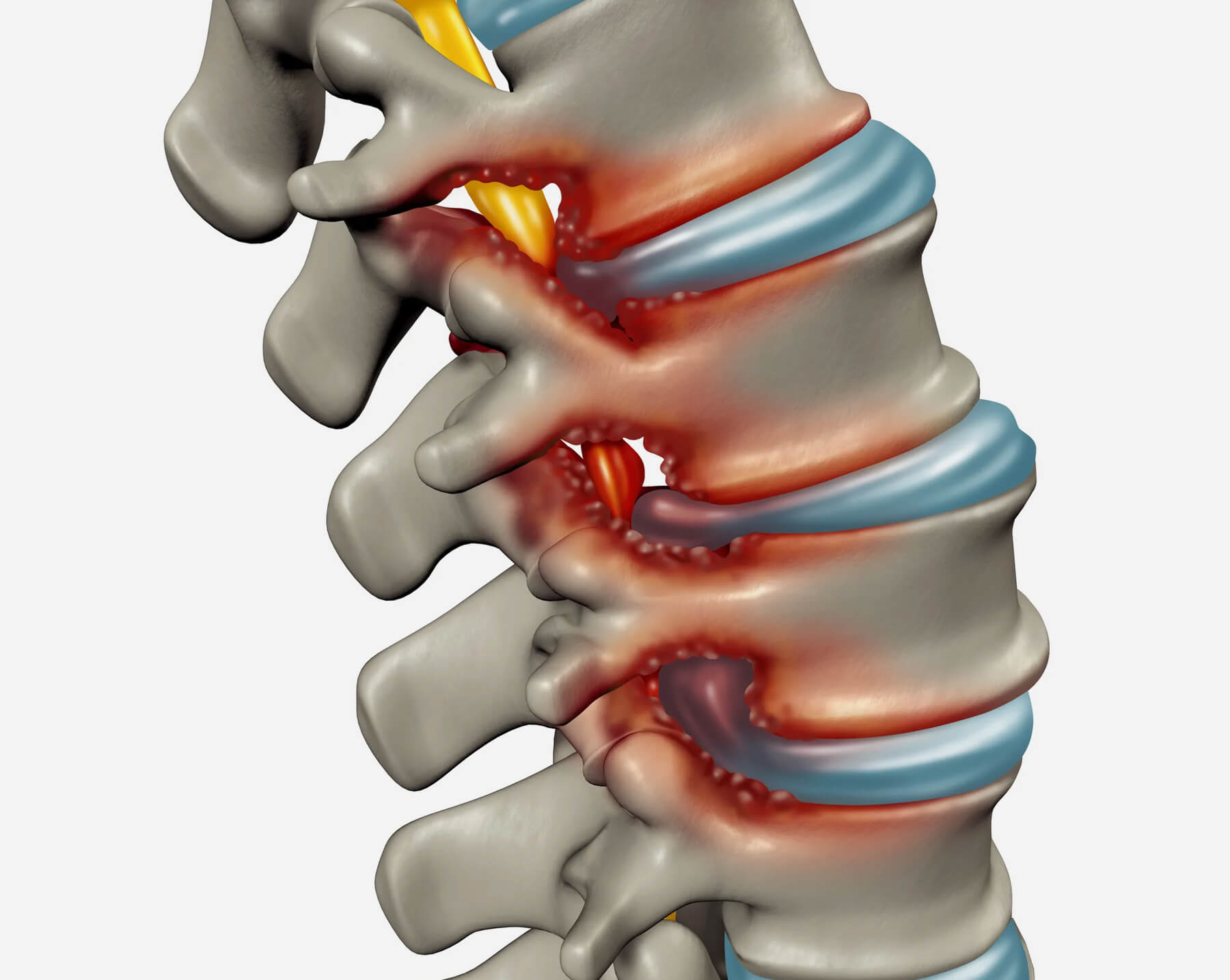 Orthopedic Doctor in Ahmedabad Orthopedic Doctor in Ahmedabad
