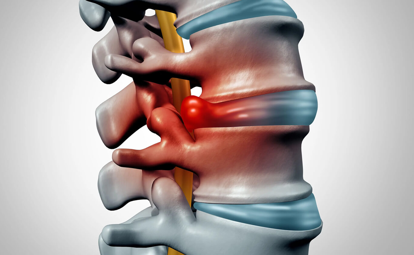 Orthopedic Doctor in Ahmedabad Orthopedic Doctor in Ahmedabad
